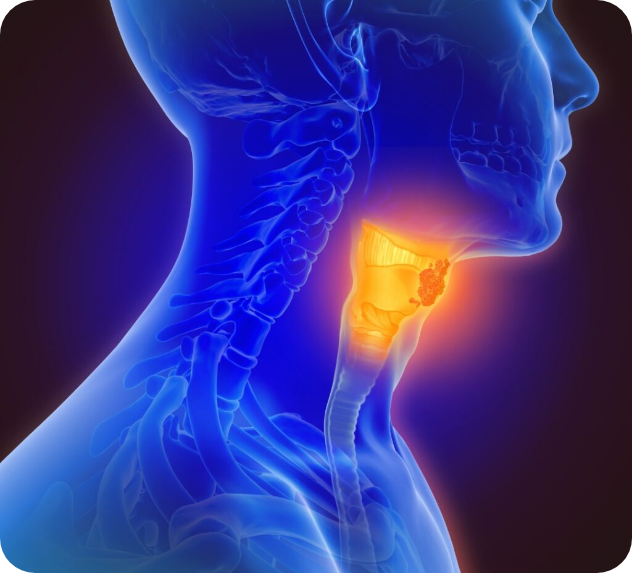 hypothyroidism-hyperthyroidism